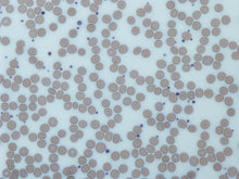 Load image into Gallery viewer, Slide Of Platelets