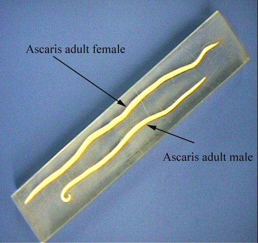 Ascaris Male/Female (Acrylic)