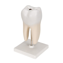 Load image into Gallery viewer, Human Triple Root Molar Model - Small
