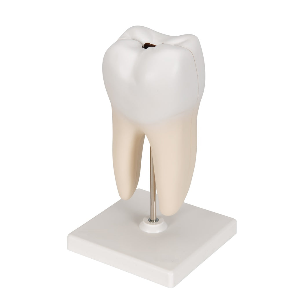 Human Triple Root Molar Model - Small