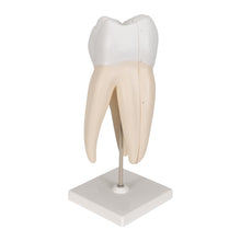 Load image into Gallery viewer, Human Triple Root Molar Model - Small
