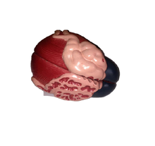 Load image into Gallery viewer, Human Urinary Bladder Model
