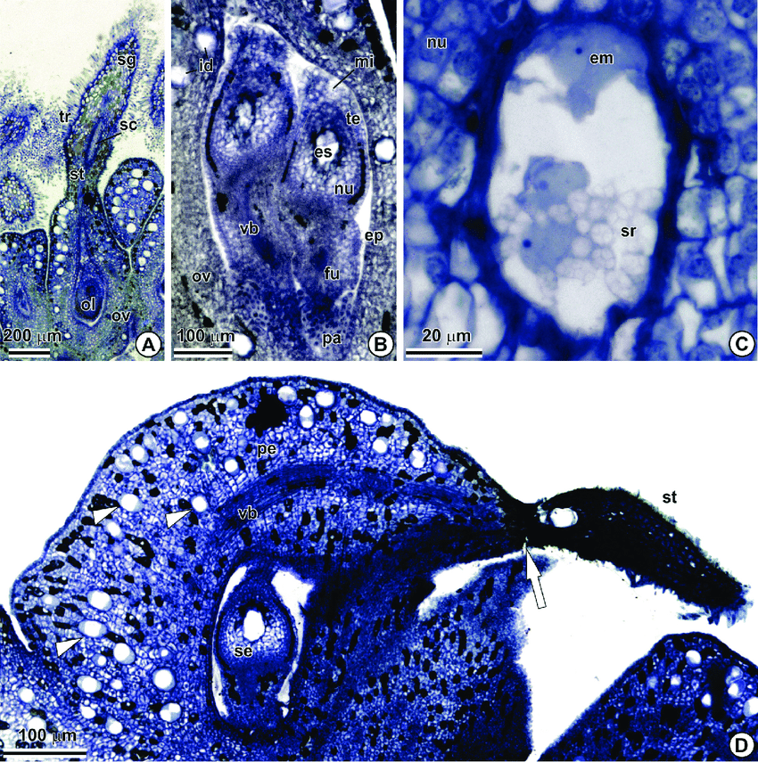 Slide Of Types Of Gynoecium