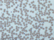Load image into Gallery viewer, Slide Of Platelets
