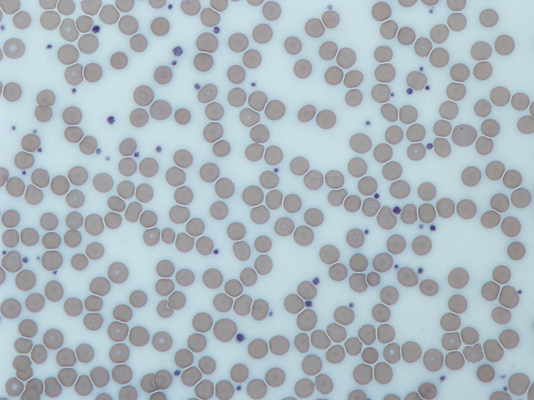 Slide Of Platelets