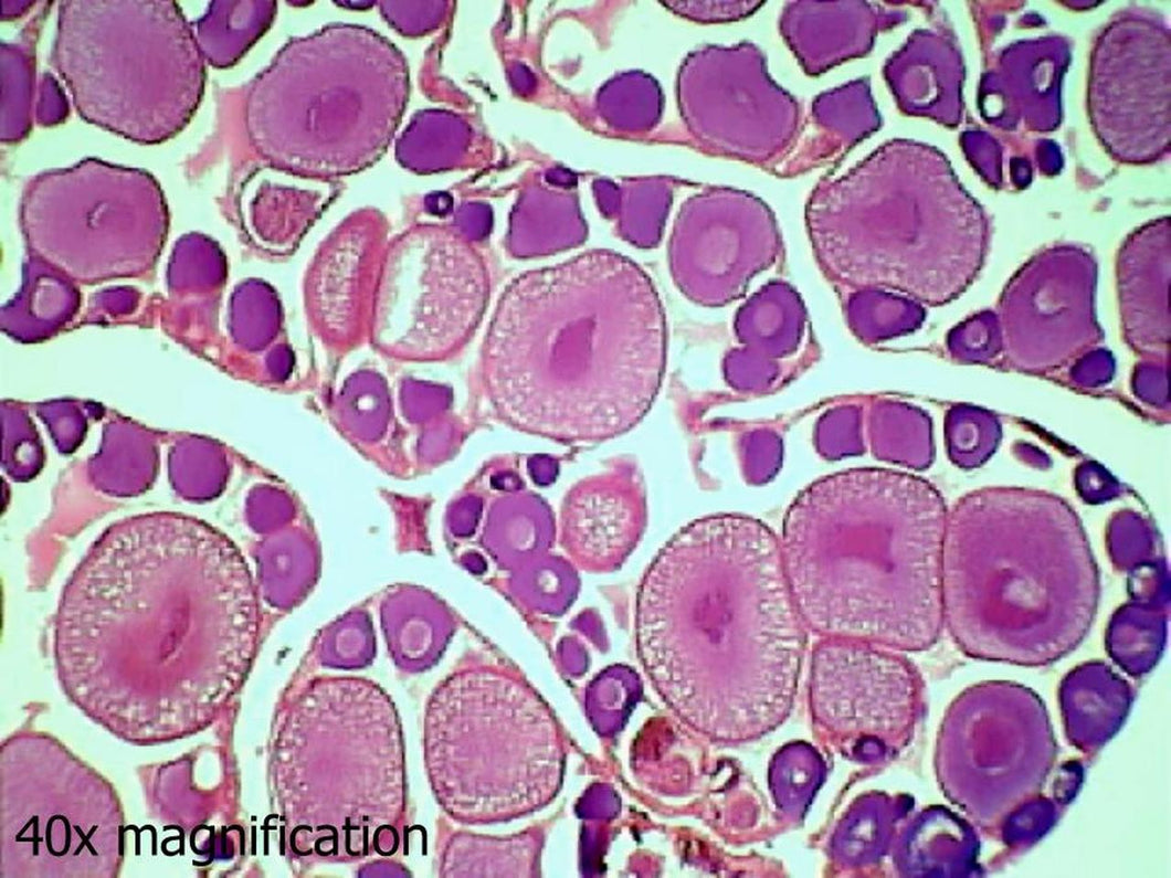 Slide Of Frog Ovary