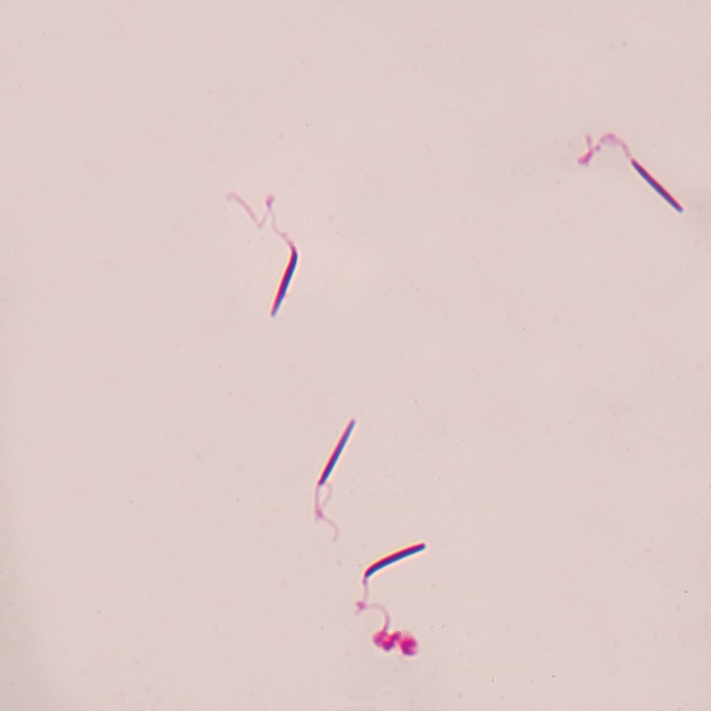 Slide Of Frog Sperm