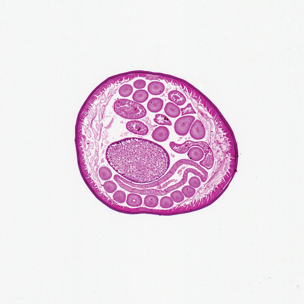 Slide  Of Ascaris Ovary