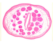 Load image into Gallery viewer, Slide Of Male Ascaris

