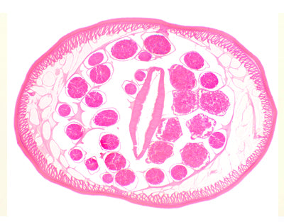 Slide Of Male Ascaris