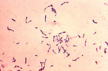 Load image into Gallery viewer, Slide Of Diphtheria
