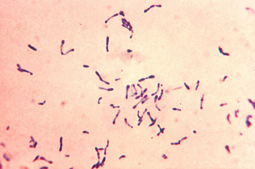 Slide Of Diphtheria