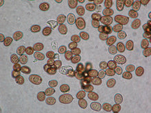 Load image into Gallery viewer, Slide Of Fungi Kingdom (Set Of 15)
