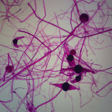 Load image into Gallery viewer, Slide Of Fungi
