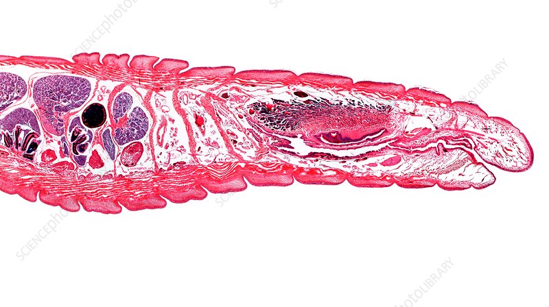 Slide Of Earth Worm Seminal tube