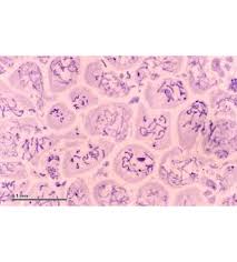 Slide Of Animal Meiosis (Set Of 5 Slides)