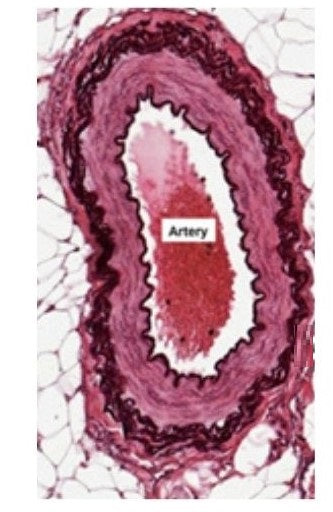 Slide Of Human Artery