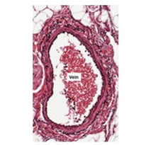 Load image into Gallery viewer, Slide Of Human Vein
