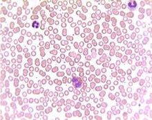 Load image into Gallery viewer, Slide Of Mammal Blood

