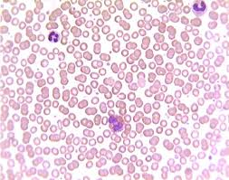 Slide Of Mammal Blood
