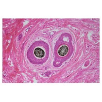 Slide Of T.S Human Skin