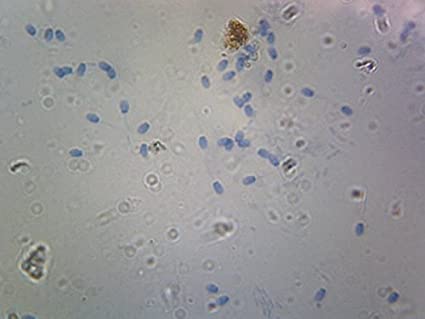 Slide Of Sperm For Mammals