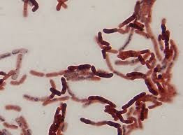 Slide Of Megatherium Bacteria