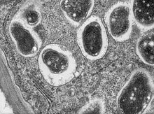 Load image into Gallery viewer, Slide Of Rhizobium Infected Root
