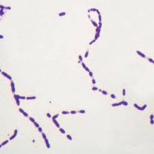Load image into Gallery viewer, Slide Of Bacterial Spore
