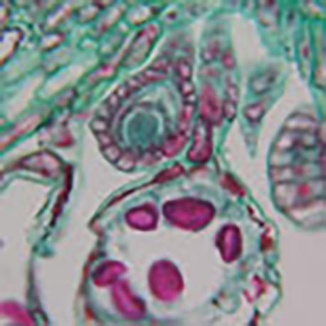 Slide Of Fern Leaf