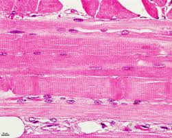 Slide Of Skeletal Muscle