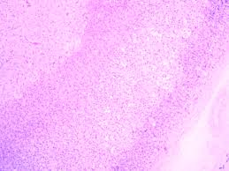 Slide Of Adrenal Gland