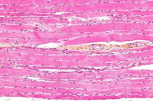 Load image into Gallery viewer, Slide Of Striated Muscle
