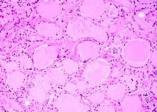 Load image into Gallery viewer, Slide Of Thyroid Gland

