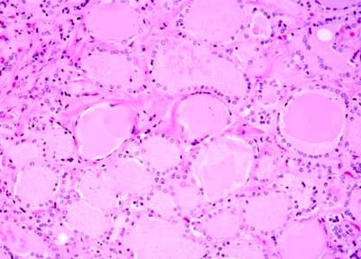Slide Of Thyroid Gland