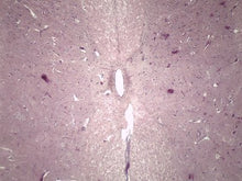 Load image into Gallery viewer, Slide Of Spinal Cord
