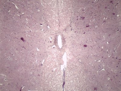 Slide Of Spinal Cord