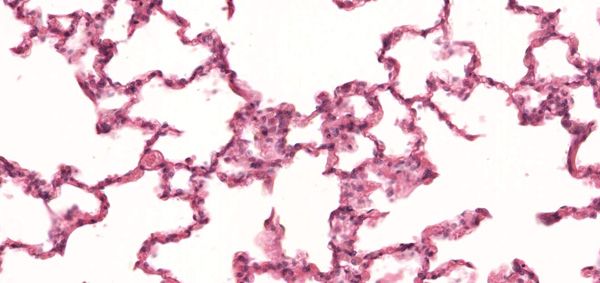 Slide Of Human Aveoli