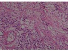 Load image into Gallery viewer, Slide Of Ovary
