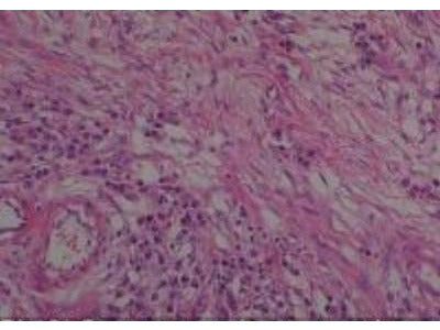 Slide Of Ovary
