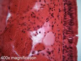 Trachea, Sec. - Slide