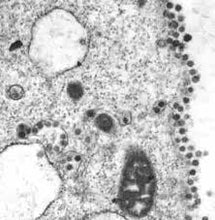 Load image into Gallery viewer, Slide Of Corona Virus
