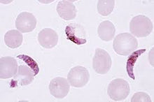 Load image into Gallery viewer, Slide Of Plasmodium

