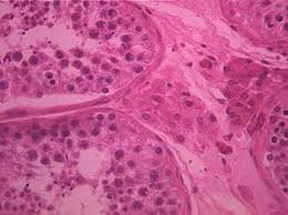 Slide Of Human Testis