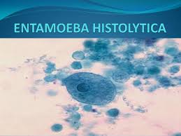Slide Of Entamoeba Histolytica