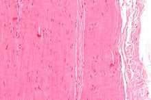 Load image into Gallery viewer, Slide Of T.S Tendon
