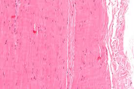 Slide Of T.S Tendon
