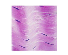 Load image into Gallery viewer, Slide Of T.S Ligament
