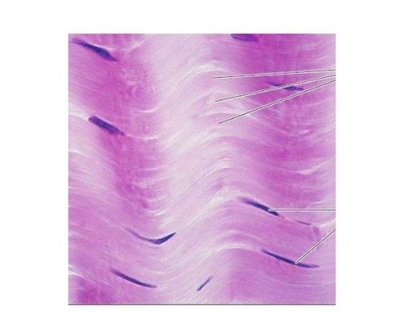 Slide Of T.S Ligament